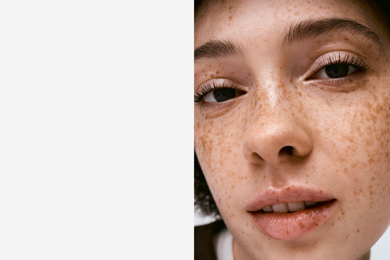 Acné & Oneffenheden