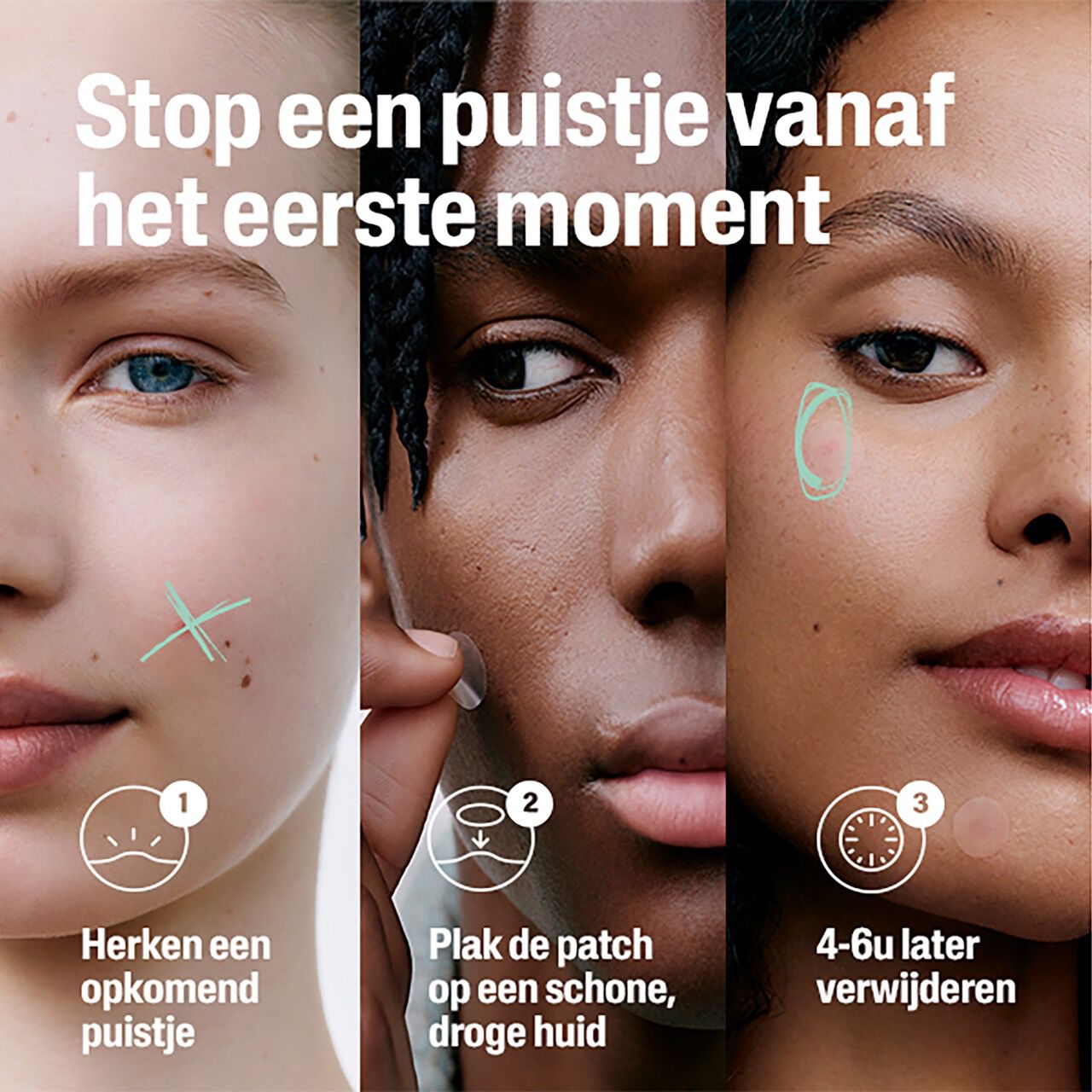 Cetaphil 6 hour fast clear pimple patch