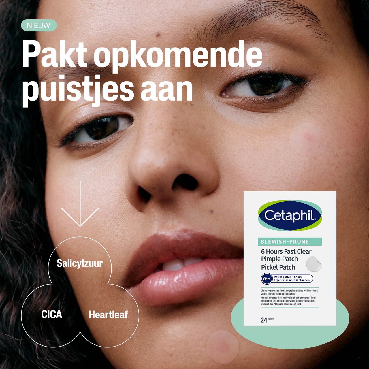Cetaphil 6 hour fast clear pimple patch
